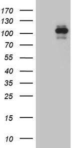 ROR2 Antibody in Western Blot (WB)