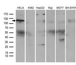 ROR2 Antibody in Western Blot (WB)