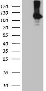 ROR2 Antibody in Western Blot (WB)