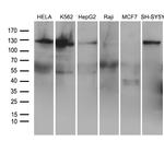 ROR2 Antibody in Western Blot (WB)