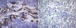 ROS1 Antibody in Immunohistochemistry (Paraffin) (IHC (P))