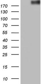 ROS1 Antibody in Western Blot (WB)