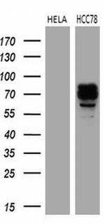 ROS1 Antibody in Western Blot (WB)