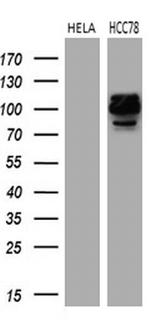 ROS1 Antibody in Western Blot (WB)