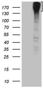 ROS1 Antibody in Western Blot (WB)