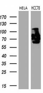 ROS1 Antibody in Western Blot (WB)