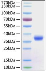 SARS-CoV-2 Spike Protein (RBD) (aa319-541), His Tag Protein in SDS-PAGE (SDS-PAGE)