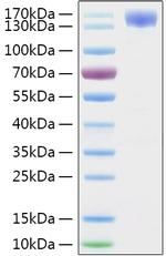 SARS-CoV-2 Spike Protein S1 (aa11-682), hFc-His Tag Protein in SDS-PAGE (SDS-PAGE)