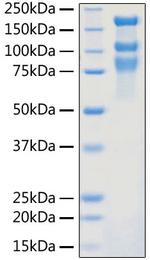 SARS-CoV-2 Spike Protein S1/S2 (aa11-1208), His Tag Protein in SDS-PAGE (SDS-PAGE)