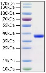 SARS-COV-2 3CL Protease (aa1-306), His and Avi Tag Protein in SDS-PAGE (SDS-PAGE)