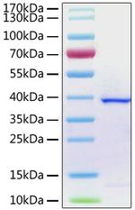 SARS-COV-2 ORF1a Polyprotein (aa1564-1878), His Tag Protein in SDS-PAGE (SDS-PAGE)