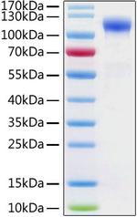 Human ACE2 (aa18-740), His-tag Protein in SDS-PAGE (SDS-PAGE)