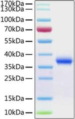 SARS-CoV-2 Spike Protein (RBD) (aa319-541), His Tag Protein in SDS-PAGE (SDS-PAGE)