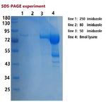 SARS-CoV-2 Nucleocapsid/Spike Protein (RBD) Protein