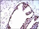 RPA70 Antibody in Immunohistochemistry (Paraffin) (IHC (P))