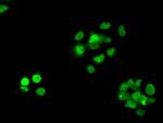 RPA2 Antibody in Immunocytochemistry (ICC/IF)