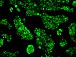 RPA2 Antibody in Immunocytochemistry (ICC/IF)