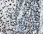 RPA2 Antibody in Immunohistochemistry (Paraffin) (IHC (P))