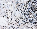 RPA2 Antibody in Immunohistochemistry (Paraffin) (IHC (P))