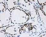 RPA2 Antibody in Immunohistochemistry (Paraffin) (IHC (P))