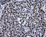 RPA2 Antibody in Immunohistochemistry (Paraffin) (IHC (P))