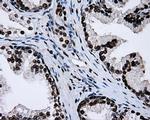 RPA2 Antibody in Immunohistochemistry (Paraffin) (IHC (P))