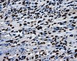 RPA2 Antibody in Immunohistochemistry (Paraffin) (IHC (P))