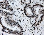 RPA2 Antibody in Immunohistochemistry (Paraffin) (IHC (P))