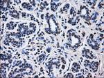 RPA2 Antibody in Immunohistochemistry (Paraffin) (IHC (P))