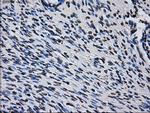 RPA2 Antibody in Immunohistochemistry (Paraffin) (IHC (P))