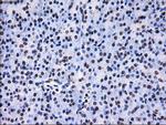 RPA2 Antibody in Immunohistochemistry (Paraffin) (IHC (P))