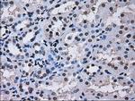 RPA2 Antibody in Immunohistochemistry (Paraffin) (IHC (P))