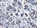 RPA2 Antibody in Immunohistochemistry (Paraffin) (IHC (P))