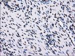 RPA2 Antibody in Immunohistochemistry (Paraffin) (IHC (P))