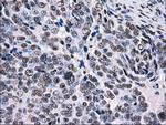 RPA2 Antibody in Immunohistochemistry (Paraffin) (IHC (P))