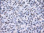 RPA2 Antibody in Immunohistochemistry (Paraffin) (IHC (P))