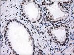 RPA2 Antibody in Immunohistochemistry (Paraffin) (IHC (P))