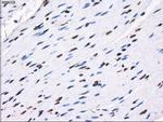 RPA2 Antibody in Immunohistochemistry (Paraffin) (IHC (P))