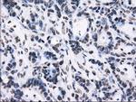 RPA2 Antibody in Immunohistochemistry (Paraffin) (IHC (P))