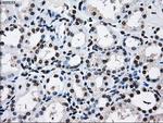 RPA2 Antibody in Immunohistochemistry (Paraffin) (IHC (P))