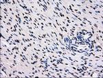 RPA2 Antibody in Immunohistochemistry (Paraffin) (IHC (P))