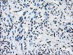 RPA2 Antibody in Immunohistochemistry (Paraffin) (IHC (P))