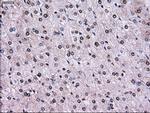 RPA2 Antibody in Immunohistochemistry (Paraffin) (IHC (P))