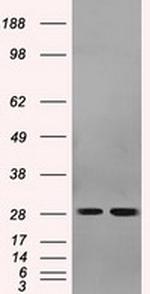 RPA2 Antibody in Western Blot (WB)