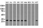 RPA2 Antibody in Western Blot (WB)