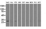 RPA2 Antibody in Western Blot (WB)