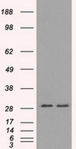 RPA2 Antibody in Western Blot (WB)