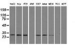 RPA2 Antibody in Western Blot (WB)