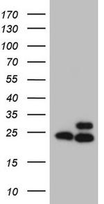 RPL10 Antibody in Western Blot (WB)