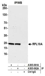 RPL10A/Ribosomal Protein L10a Antibody in Western Blot (WB)